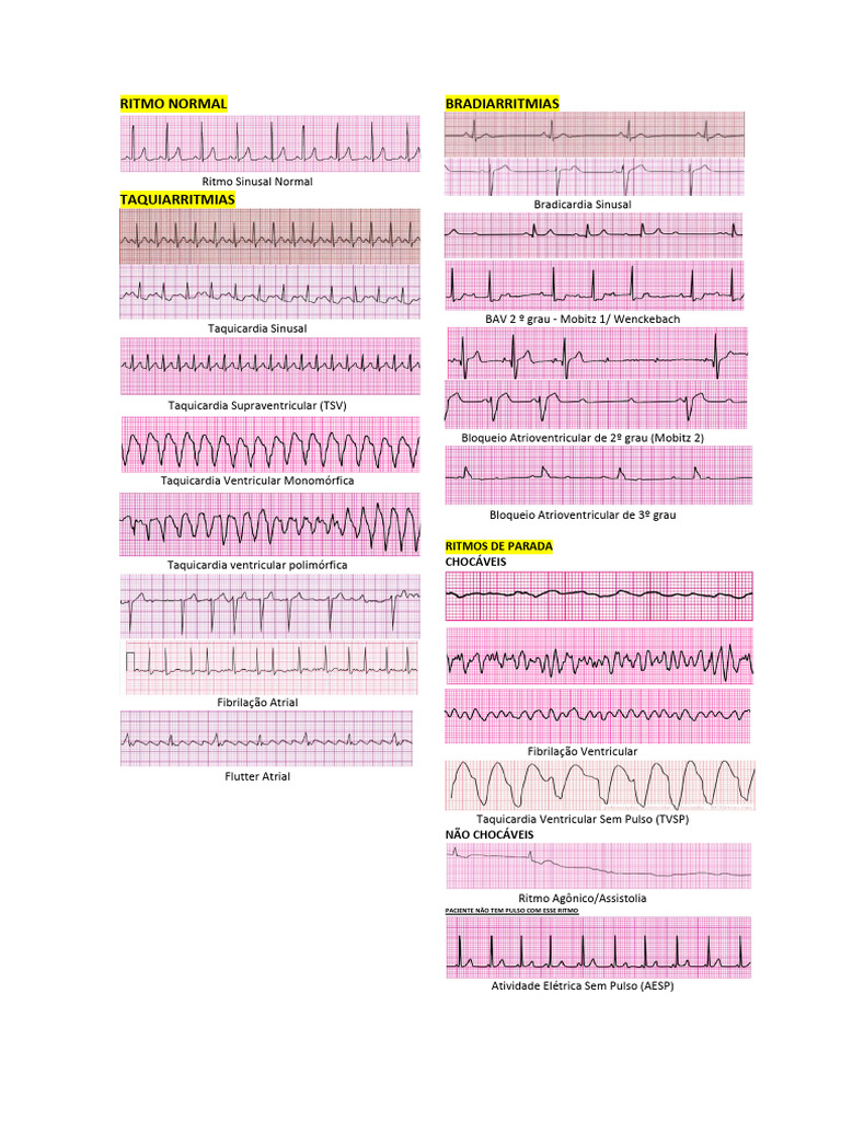 Ritmos ACLS 2 | PDF