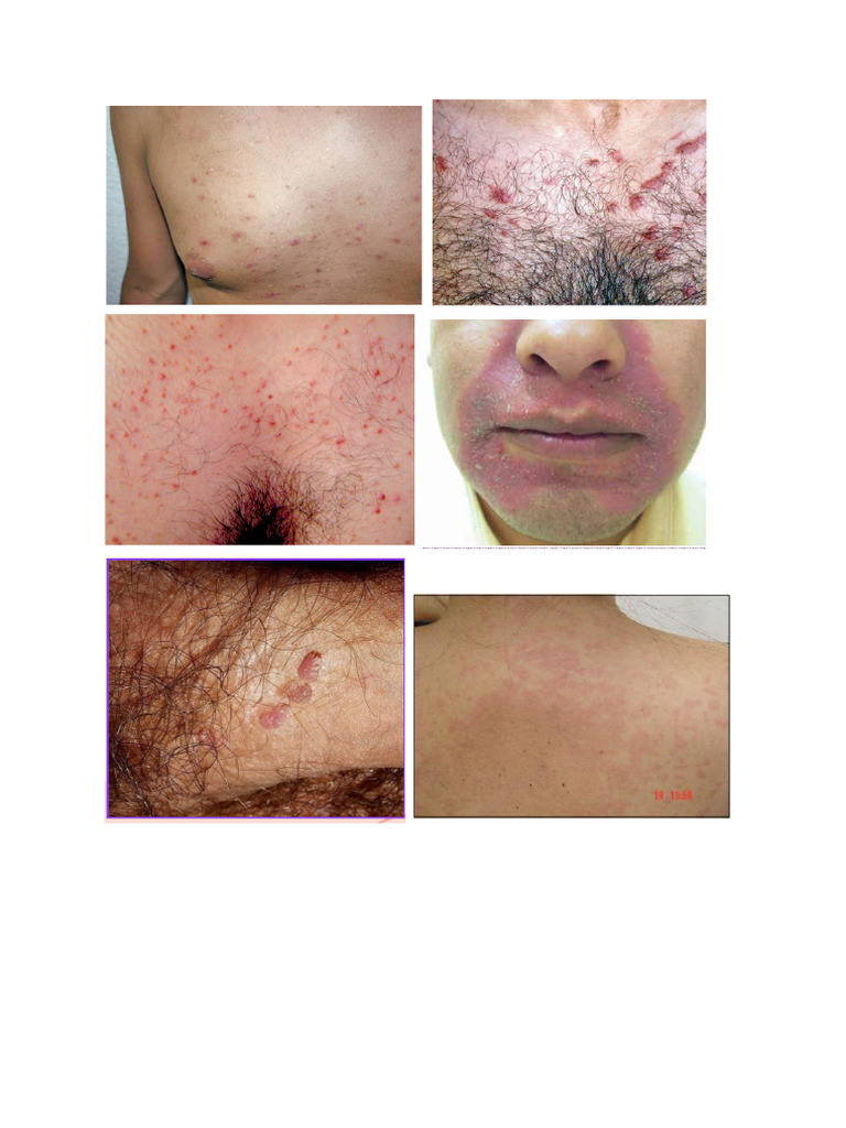 Derma | PDF