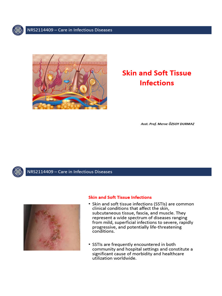Skin and Soft Tissue Infections 2 | PDF | Infection | Microbiology