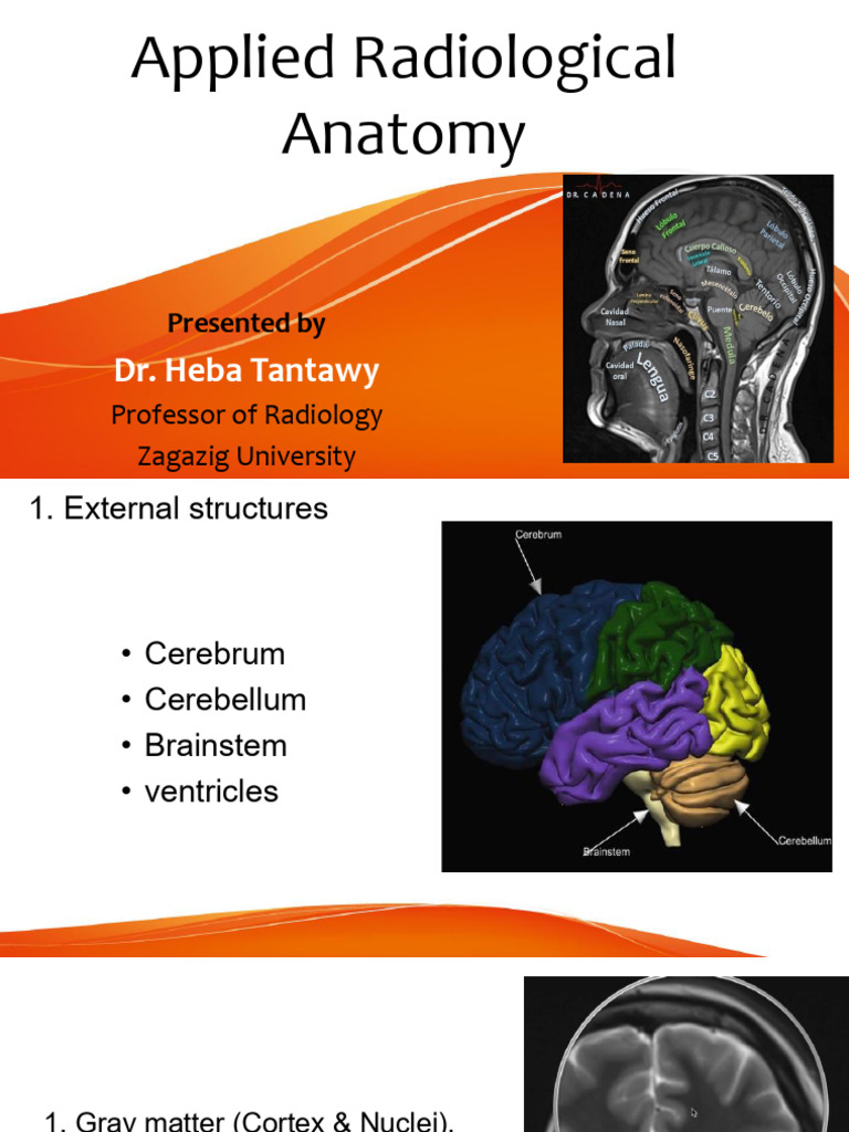 3- 4 Anatomy and Vascular (1) | PDF | Brainstem | Cerebellum