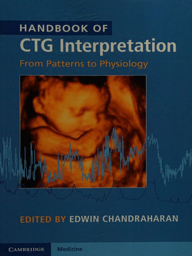 Handbook of CTG Interpretation From Patterns To Physiology Chandraharan ...