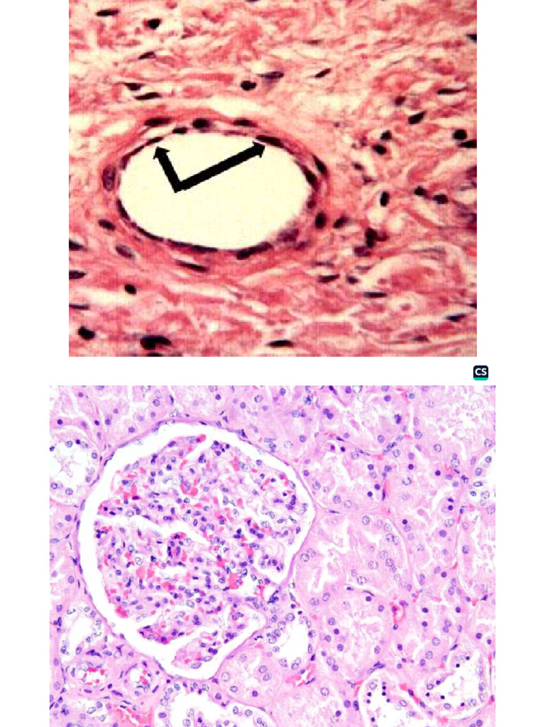 Simple Squamous | PDF