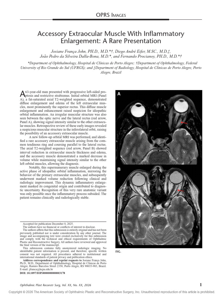 Accessory Extraocular Muscle With Inflammatory.771 | PDF | Magnetic ...