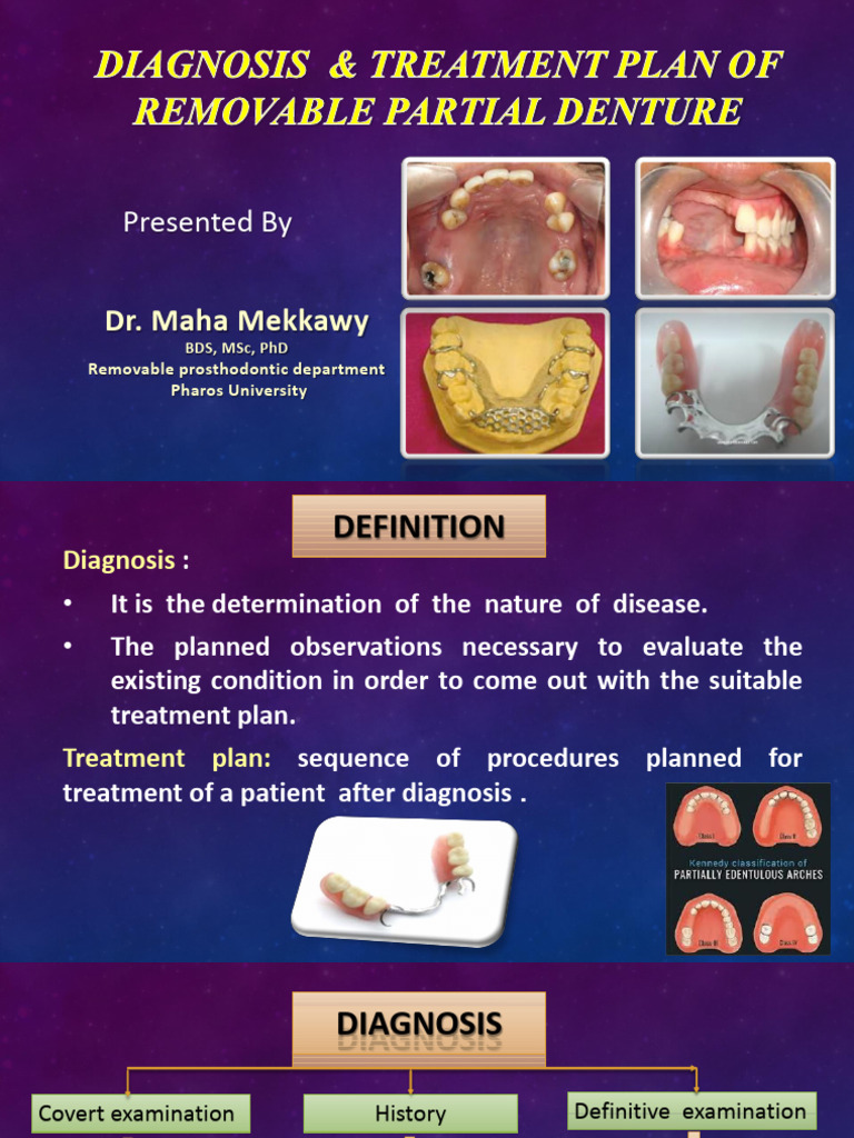 Diagnosis of RPD 1 | PDF | Dentures | Tooth