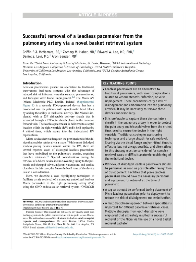 Leadless Pacemaker Retrieval – ONO Basket System – Heart Rhythm Case ...
