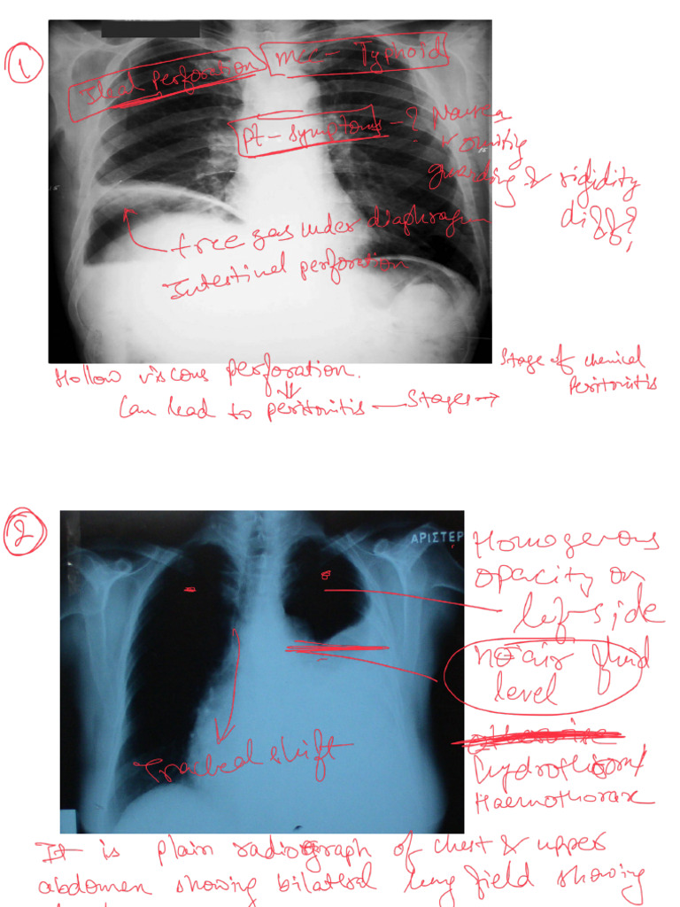 X Ray | PDF