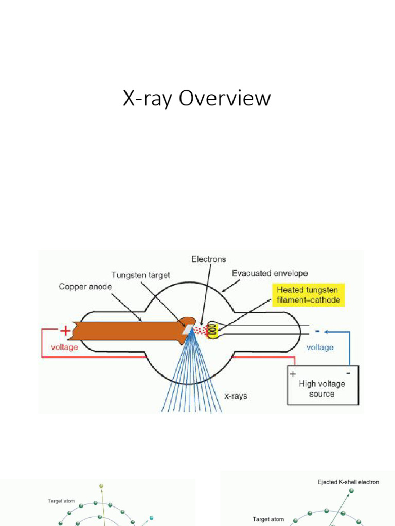 0 X-Ray Overview | PDF