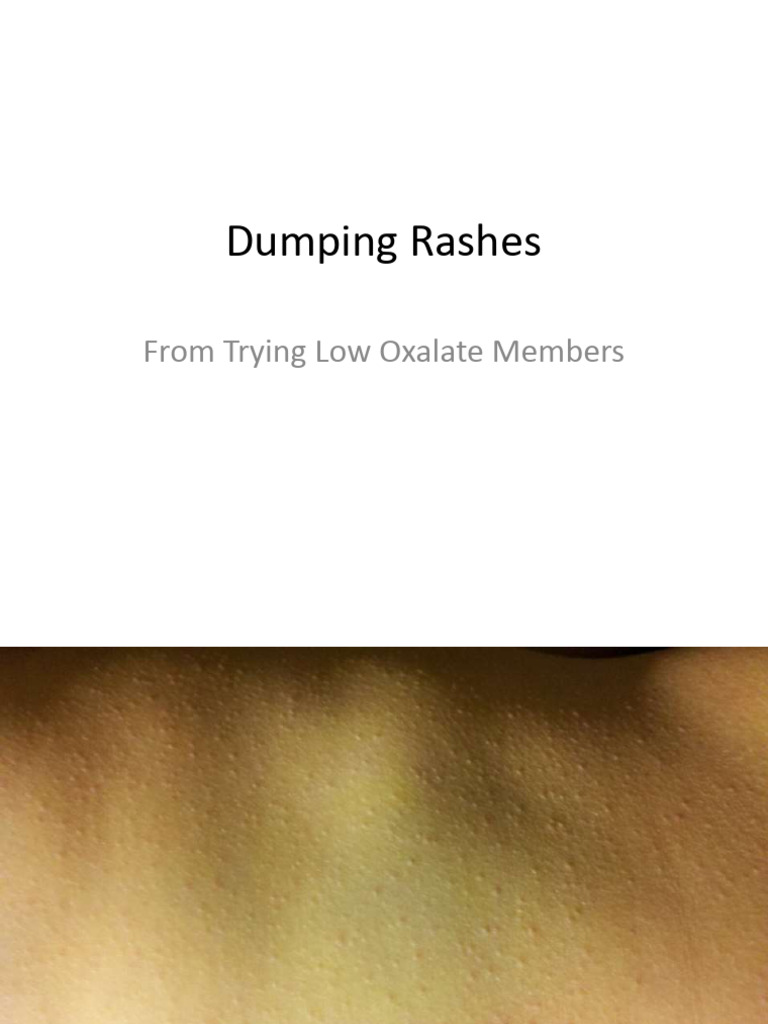 Dumping Rashes | PDF