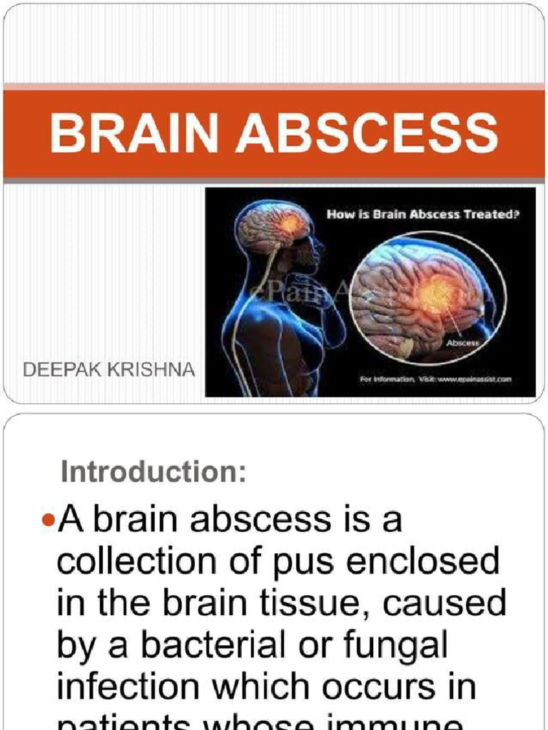 Brain Abscess | PDF