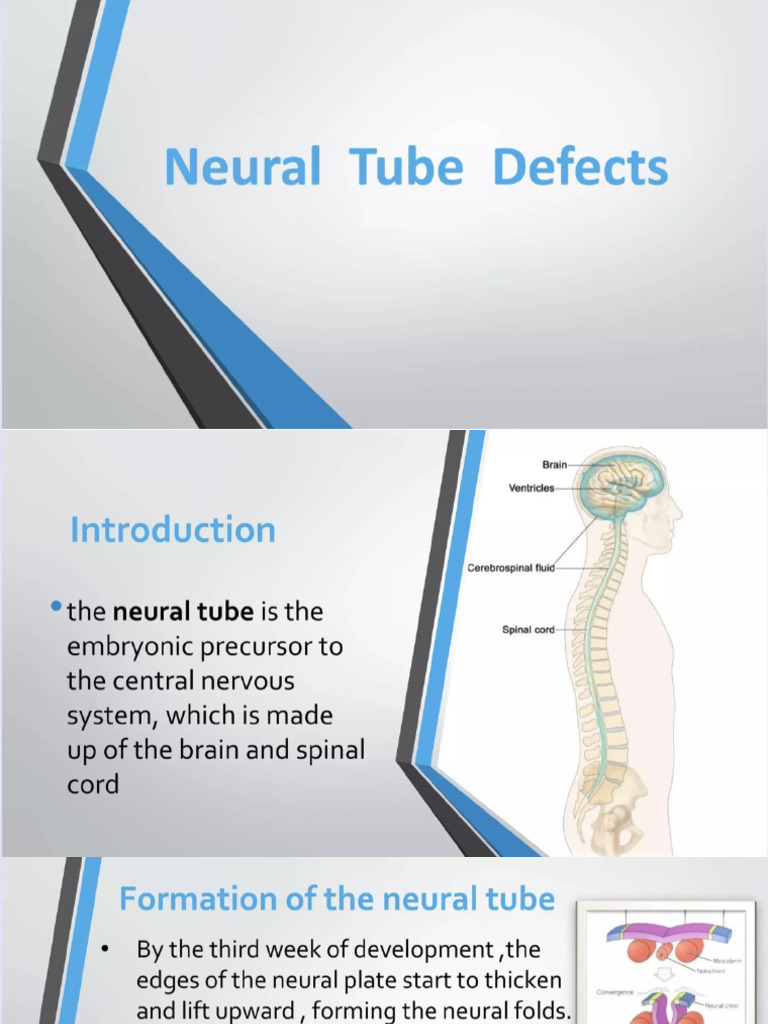 Neural Tube Defects | PDF