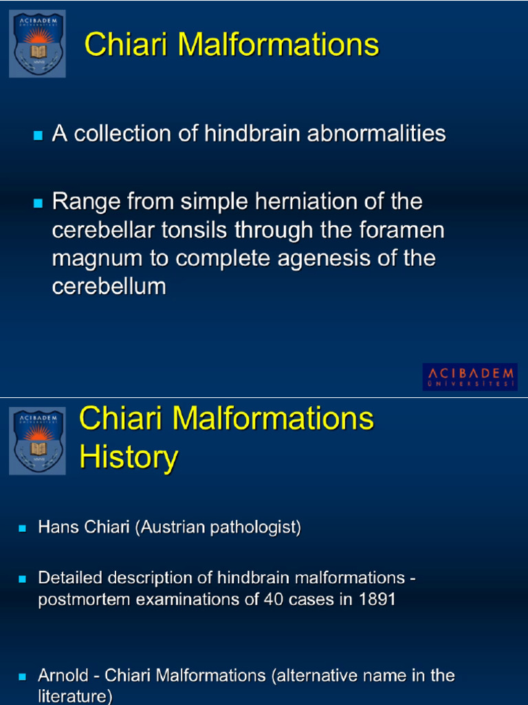 4 Chiari Malformations | PDF