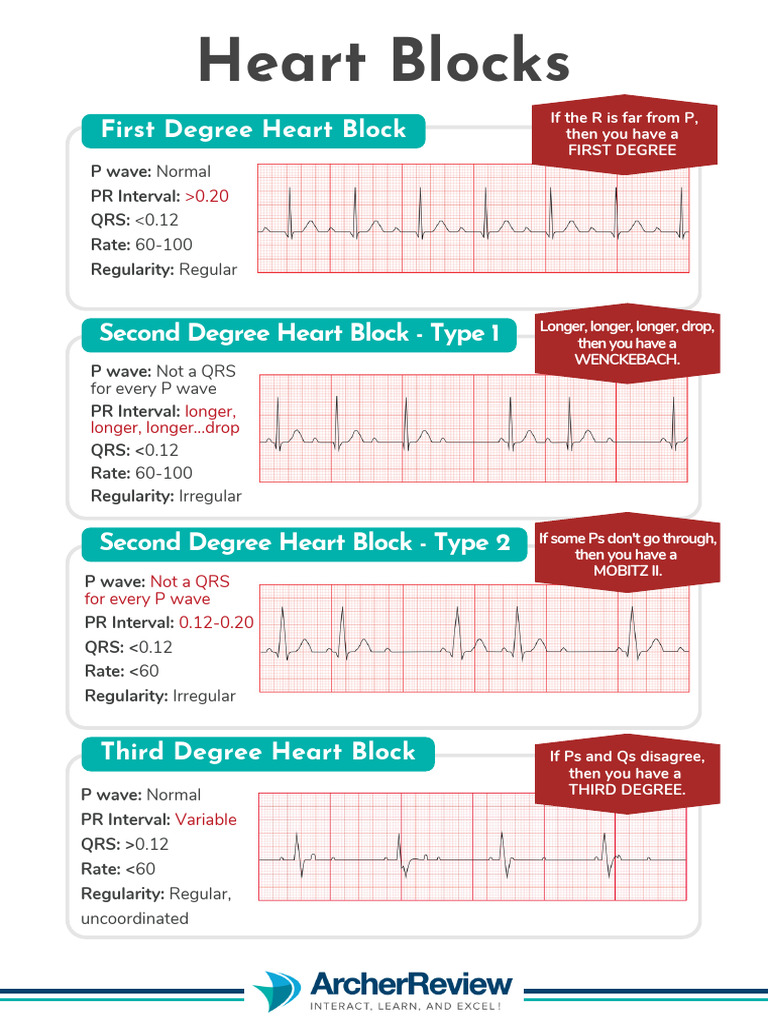 Heart Blocks | PDF