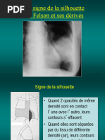 Signe de la silhouette en radiologie | PDF | Aorte | Thorax