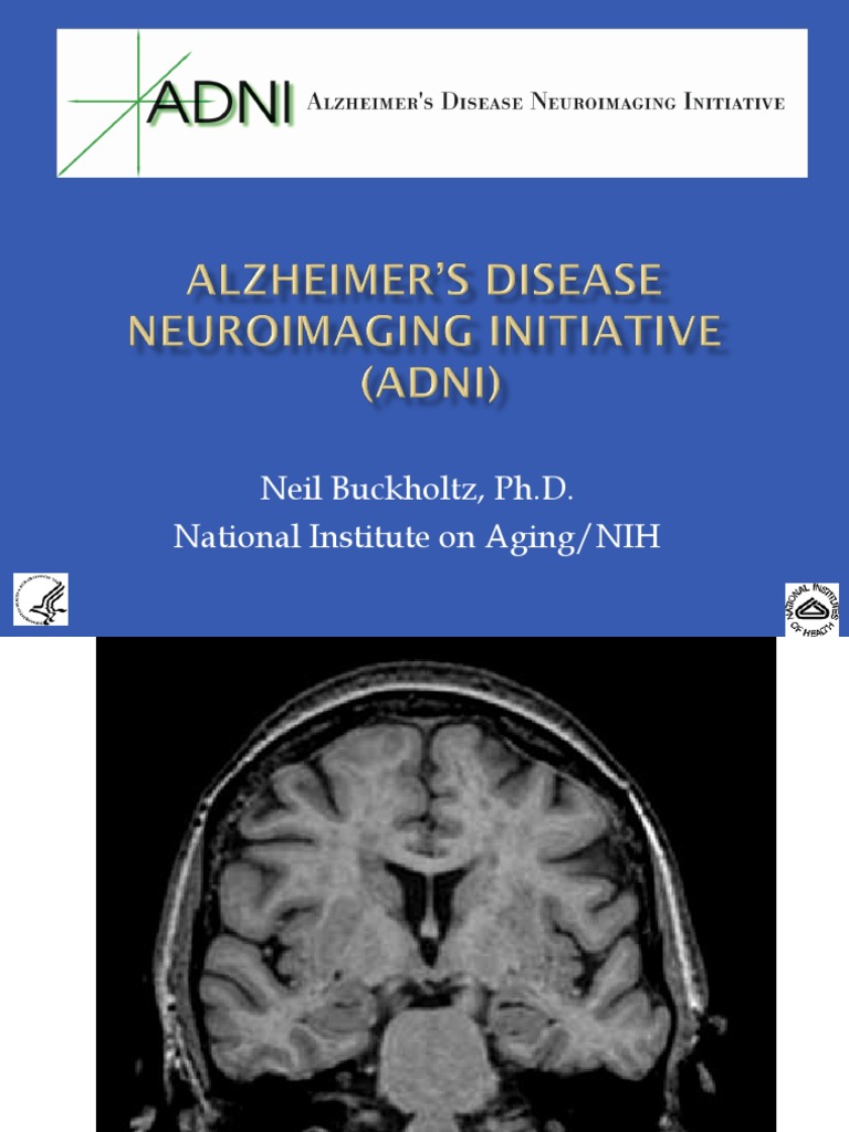 Alzheimer's Disease Neuroimaging Initiative (ADNI) | PDF | Alzheimer's ...