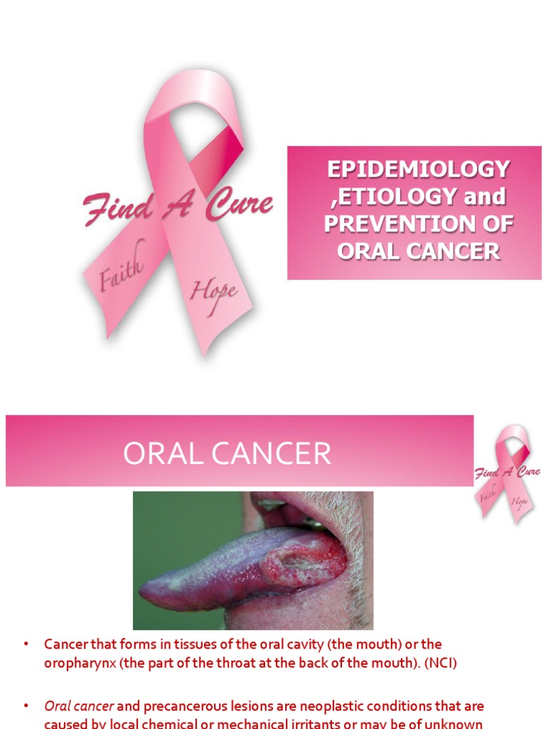 Epidemiology ,Etiology & Prevention of Oral Cancer Preventive