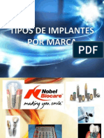 Tipos de Implantes Por Marcas