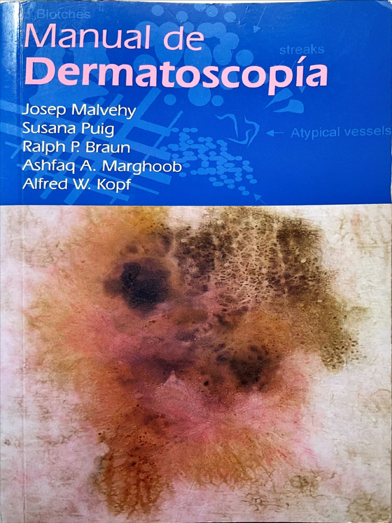 Manual de Dermatoscopía | PDF