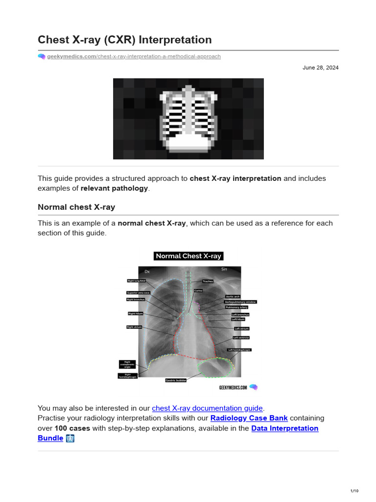Geekymedics.com-Chest X-ray CXR Interpretation | PDF | Lung | Heart