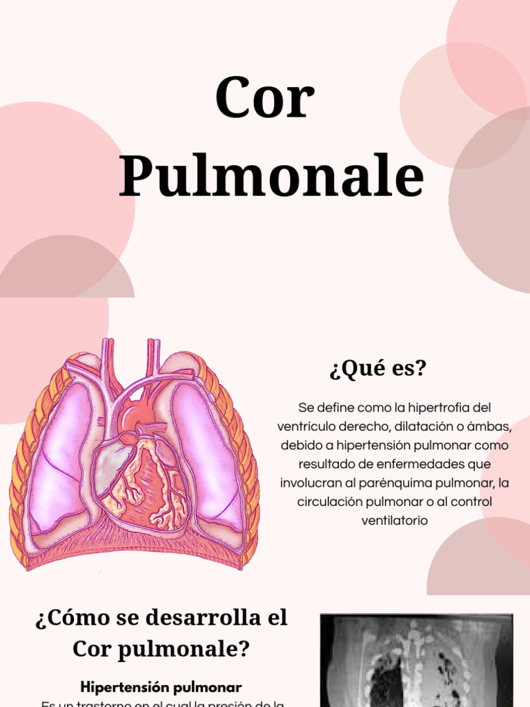 Cor Pulmonale - 20260217 - 093938 - 0000 | PDF | Pulmón | Artería