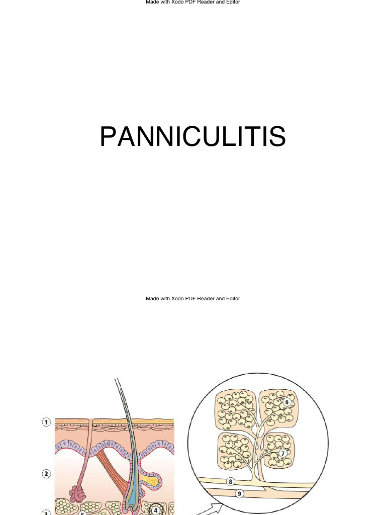 PANNICULITIS | PDF | Inflammation | Medical Specialties