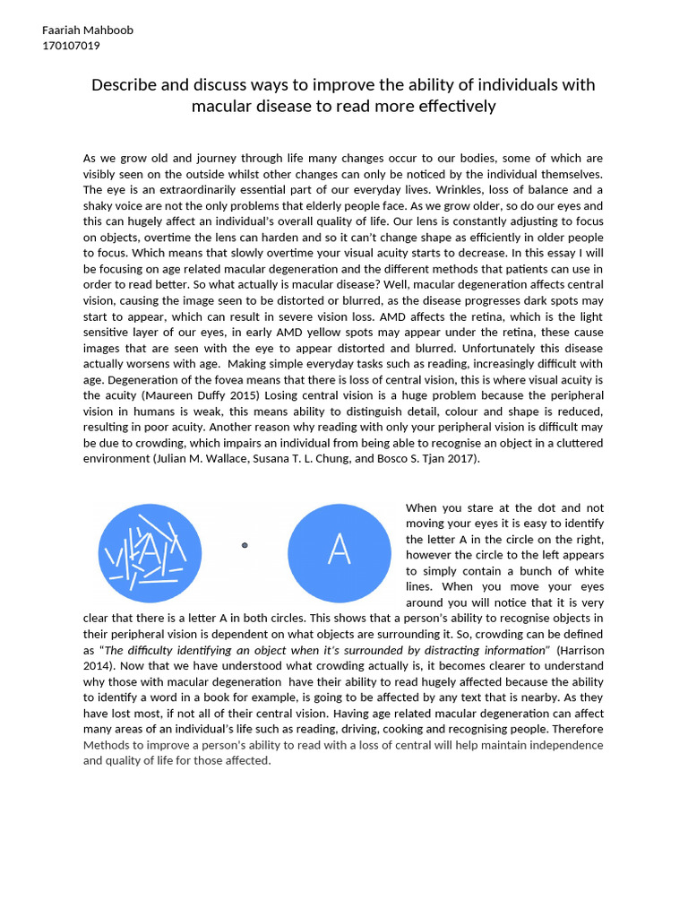 COMPLETED Essay 2 Submit | PDF | Visual Acuity | Human Eye