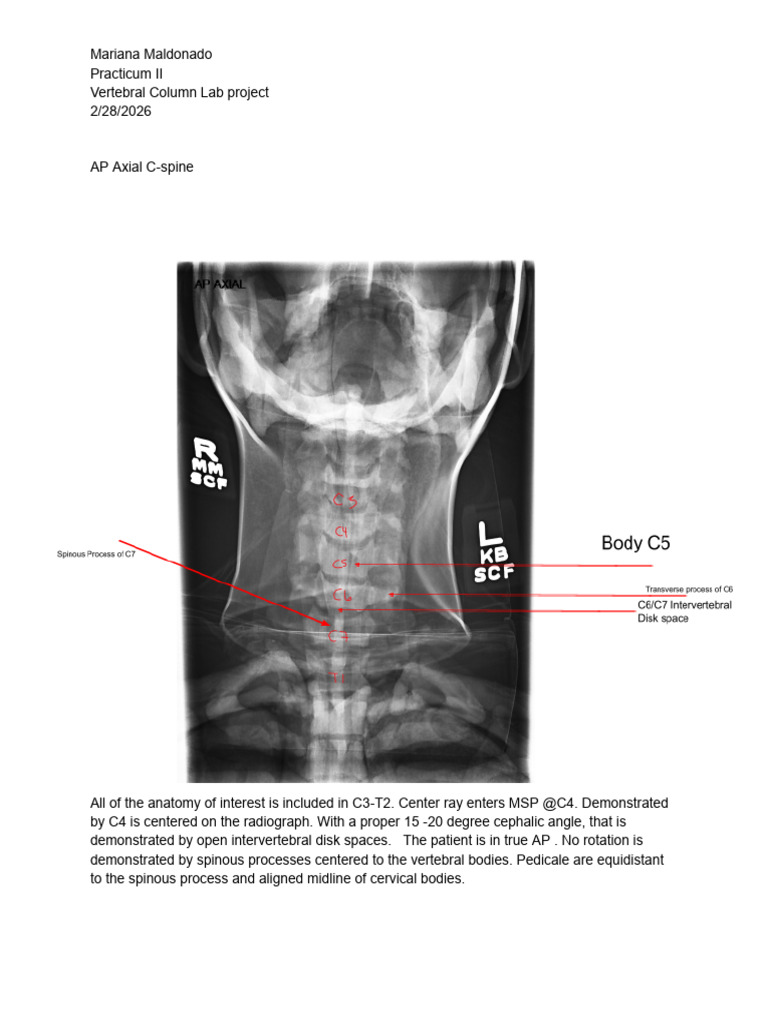 vertebral column lab project | PDF | Vertebra | Human Anatomy