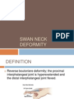 Swan Neck Deformity