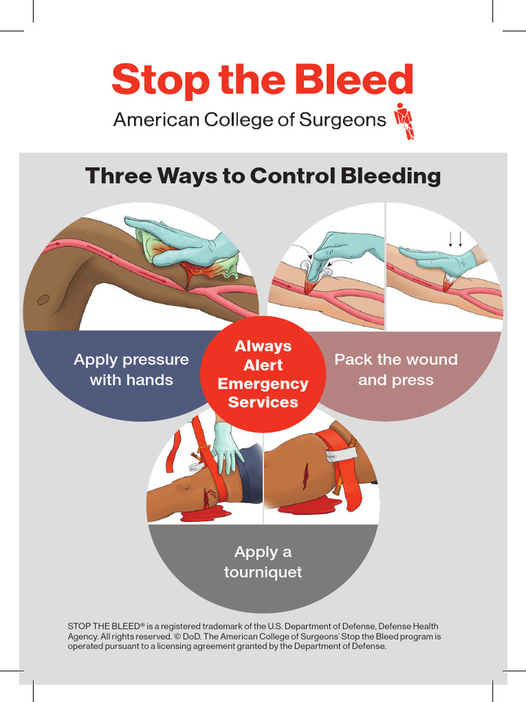 ACS - Stop Bleeding - Poster - Eng | PDF
