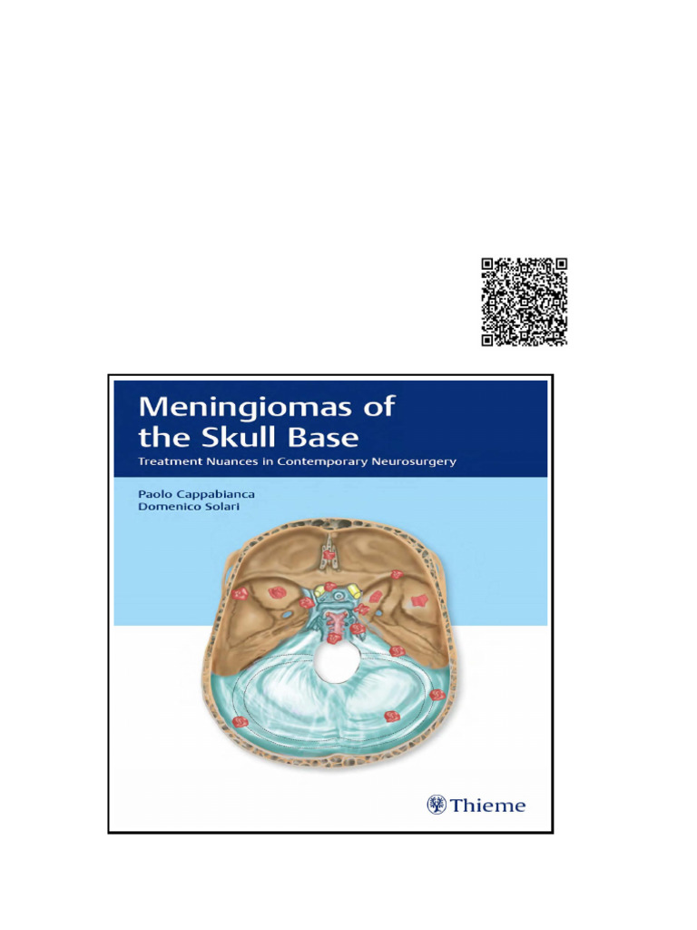 Meningiomas of The Skull Base Treatment Nuances Wei Zhi | PDF | System ...