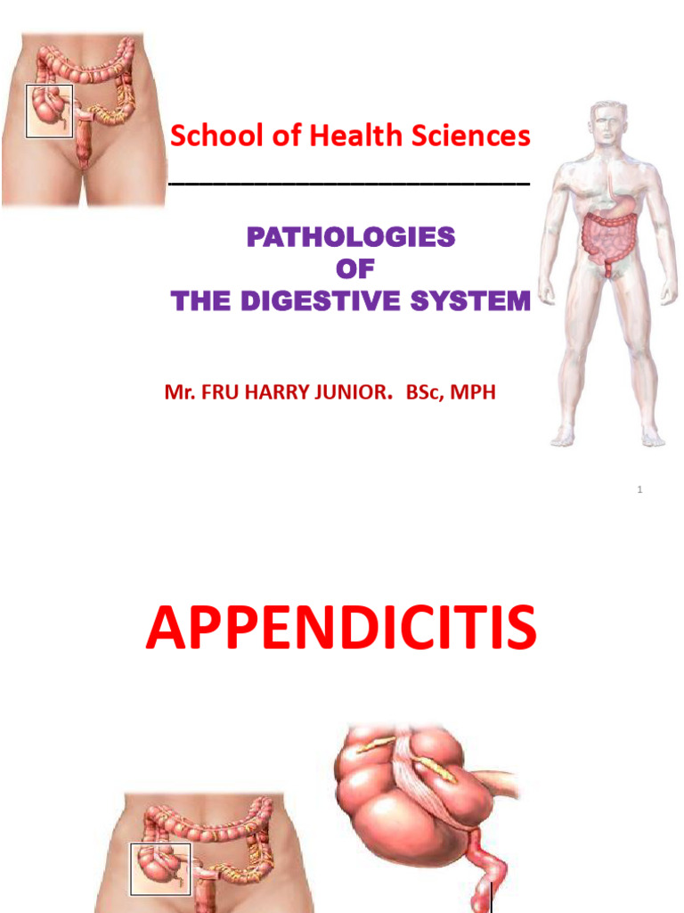 Appendicitis | PDF | Surgery | Medical Specialties