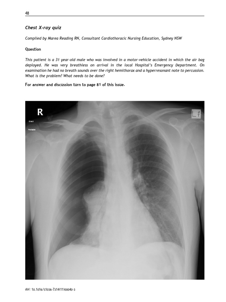 Chest X Ray Quiz (Question) Aucc | PDF