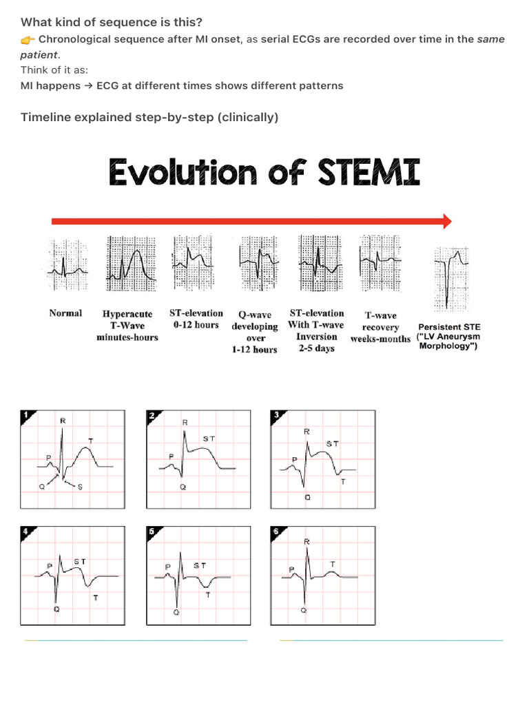 What Kind of Sequence Is This | PDF | Electrocardiography | Myocardial ...