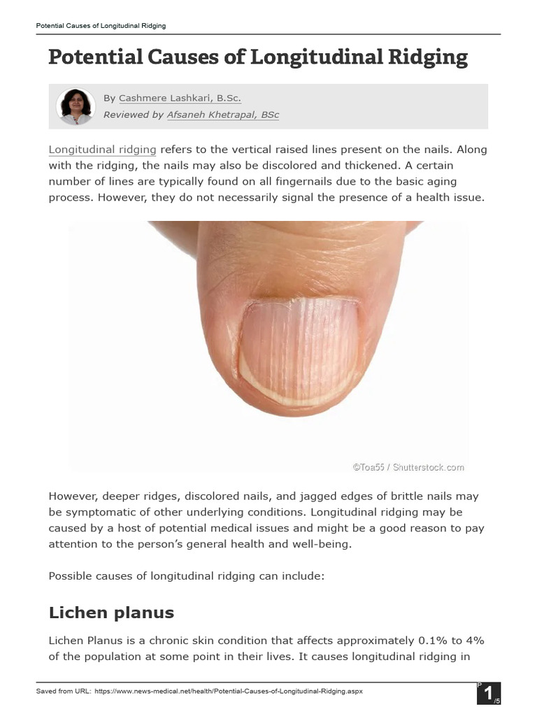 Potential Causes of Longitudinal Knails Ridging | PDF | Nail (Anatomy ...