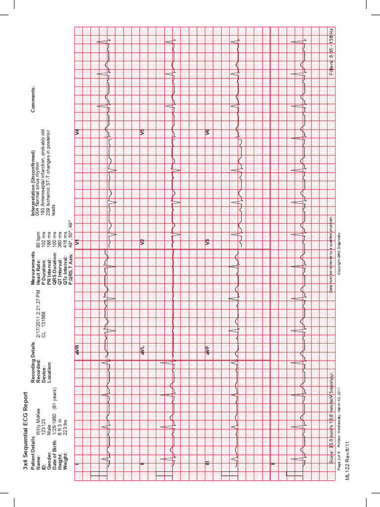 ECG Report 2 | PDF