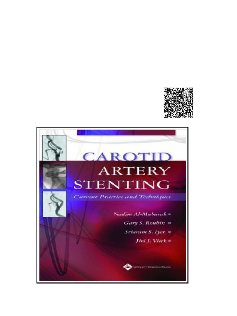 Carotid Artery Stenting Current Practice and Techniques | PDF | Rna | Iran