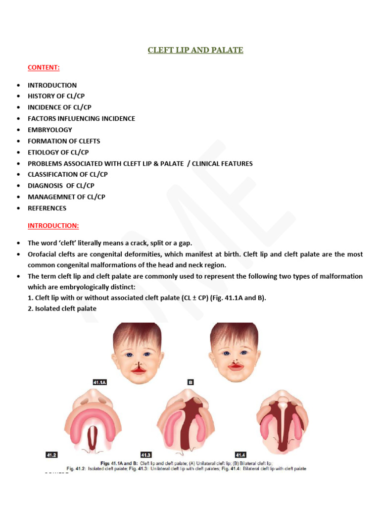 Cleft Lip and Palate | PDF | Human Nose | Medical Specialties