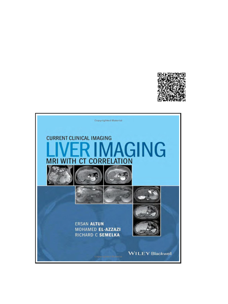 Liver imaging MRI with CT correlation | PDF