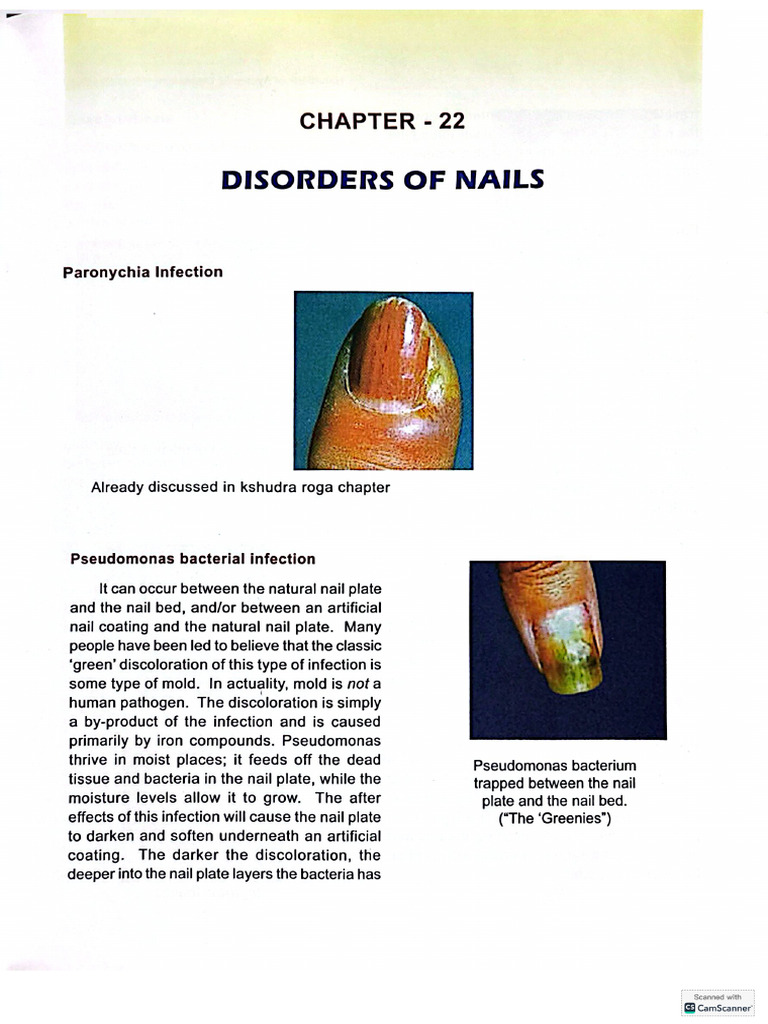 Nail Disorder | PDF