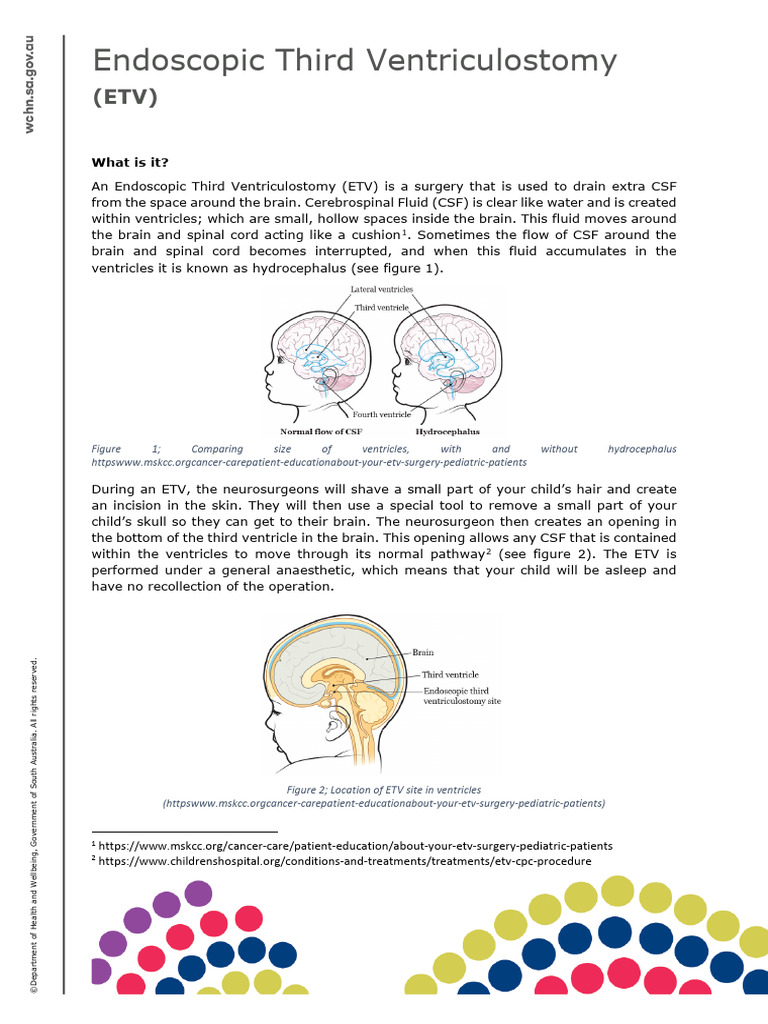 Endoscopic Third Ventriculostomy Fact Sheet | PDF | Cerebrospinal Fluid ...