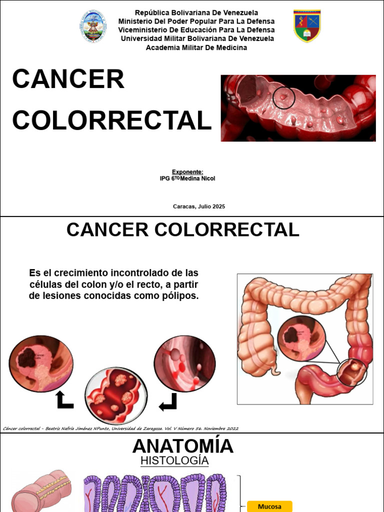 Cancer Colorrectal | PDF | Cáncer colonrectal | Cáncer