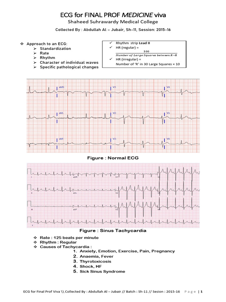 ECG For Final Prof 2022 | PDF | Electrocardiography | Heart