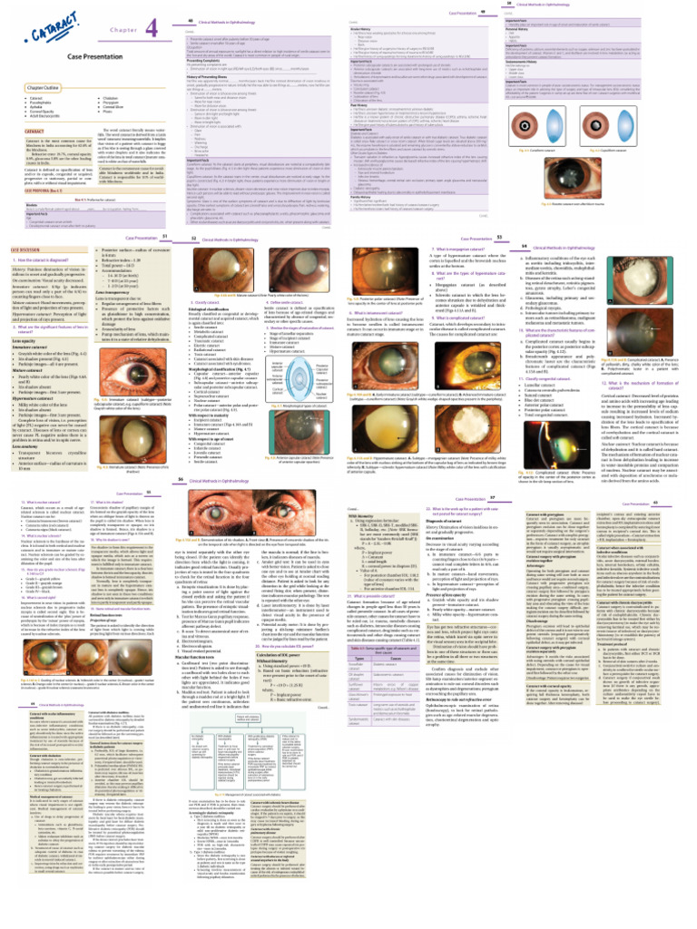 Cataract | PDF