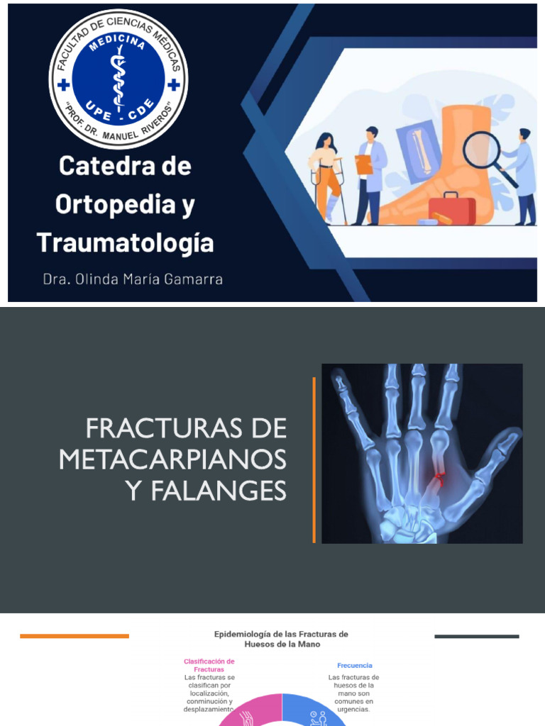 Fracturas de Metacarpianos y Falanges | PDF
