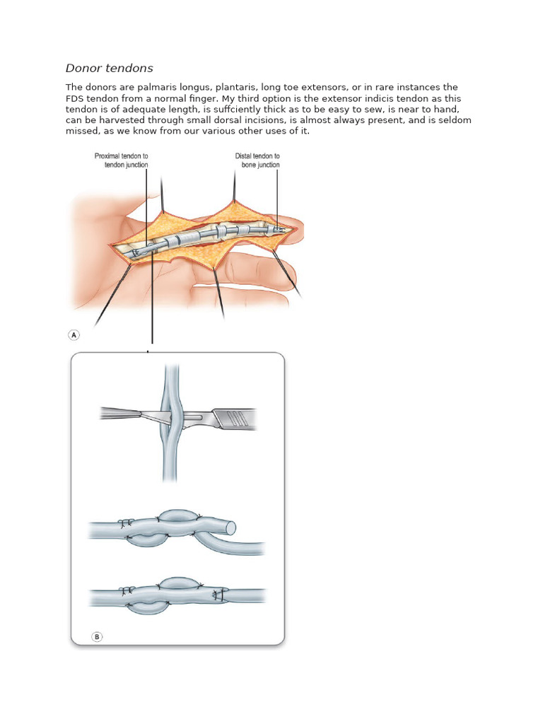 Flexor Tendon | PDF