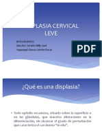 Displasia Cervical NIC I