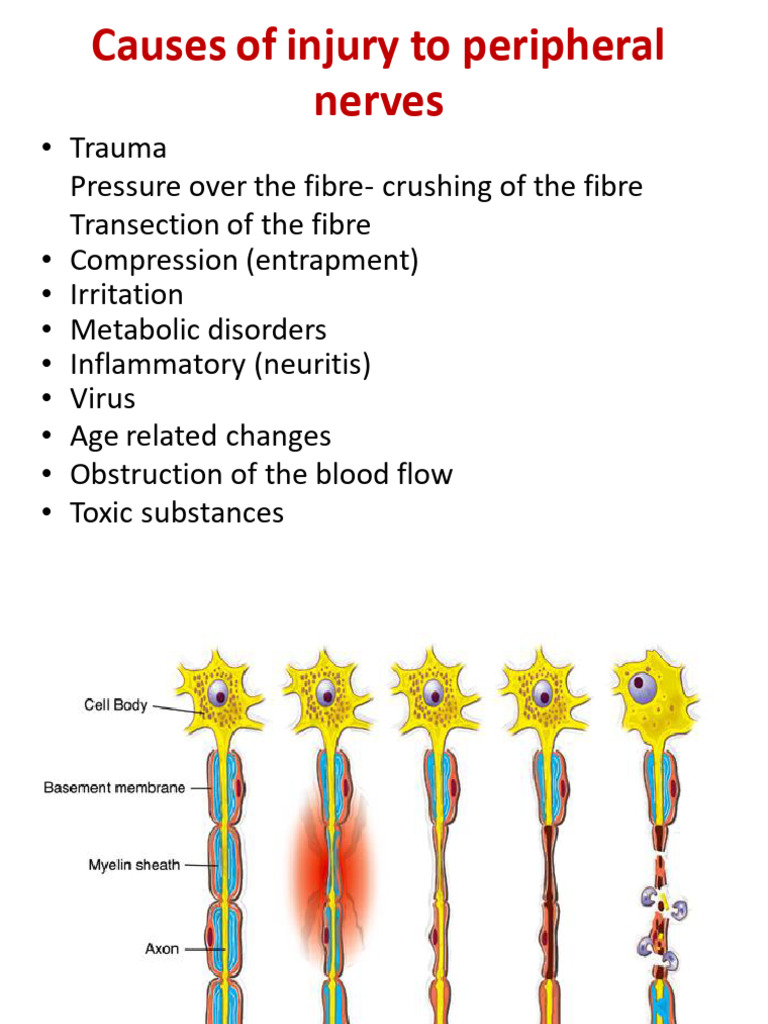 Nerve Injury 1 | PDF