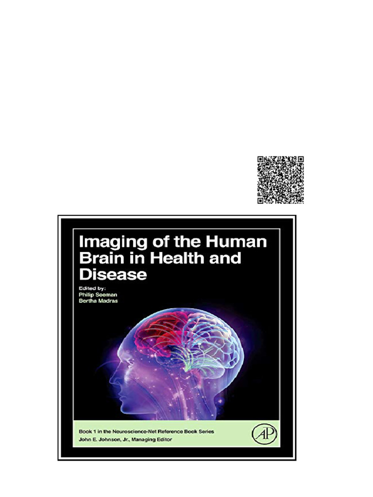 Imaging of The Human Brain in Health and Disease 1st Edition Philip ...