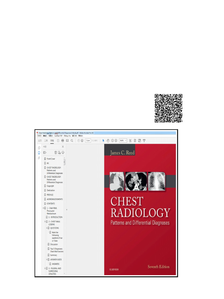 (Original PDF) Chest Radiology Patterns and Differential Diagnoses | PDF