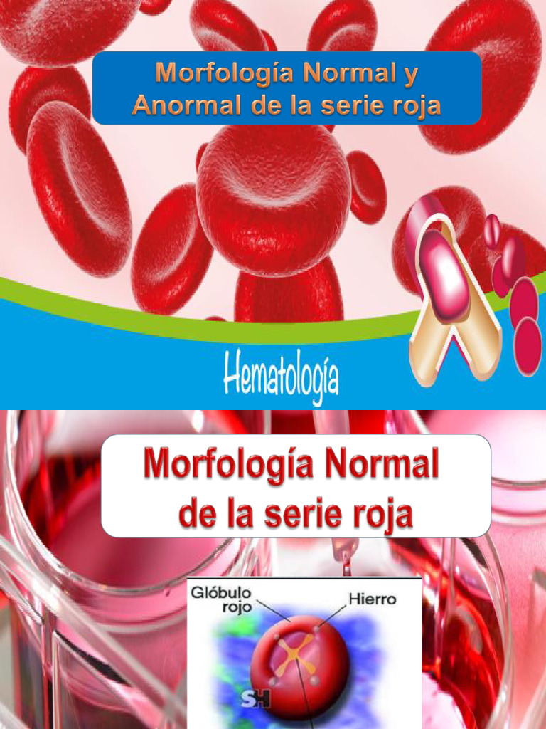 Morfologia Normal y Anormal de La Serie Roja | PDF