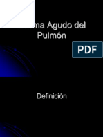 Edema Agudo del Pulmón